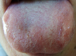 Clear Yang Clear Yang